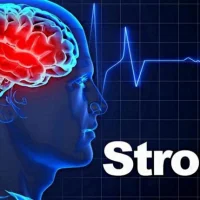 বিশ্ব স্ট্রোক দিবস