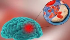 কলকাতায় ‘গুলেন বেরি’র থাবা! ভেন্টিলেশনে ২ শিশু