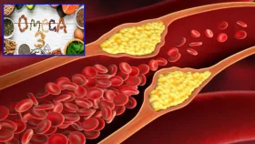 যে খাবারে কমবে খারাপ কোলেস্টেরল