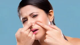 যে কারণে মধ্যবয়সে ব্রণ, সমাধানে করণীয়