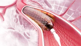 হার্টের রিংয়ের দাম কমলো