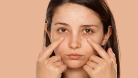 চোখের নিচে কালো দাগের কারণ ও ঘরোয়া প্রতিকার