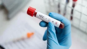 প্রাণঘাতী এইডসের টিকা তৈরিতে রাশিয়ার অগ্রগতি