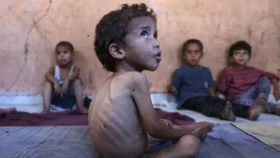 গাজায় পুষ্টিহীনতায় ভুগছে ৫৫ হাজার শিশু, ঝুঁকিতে ১২ হাজার