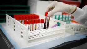 এক রক্ত পরীক্ষায় শনাক্ত হবে ৫০ ধরনের ক্যান্সার