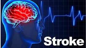 বিশ্ব স্ট্রোক দিবস আজ