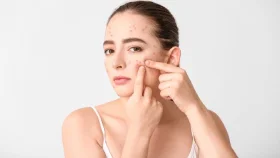 স্কিনকেয়ারের পরও কেন কমছে না ব্রণ 