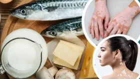 মাছ ও দুধ একসঙ্গে বা পরপর খেলে কি হয়? জেনে নিন