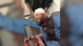 খুলনায় এনসিপি নেতাকে মাথায় গুলি, অবস্থা আশঙ্কাজনক