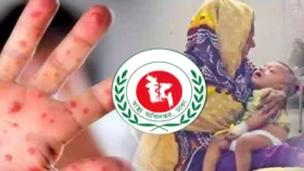 সারাদেশে হাম ও উপসর্গ নিয়ে আরও ৯ শিশুর মৃত্যু