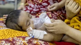 হামের উপসর্গে আরও ২ শিশুর মৃত্যু