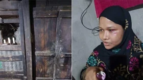 গৃহবধূর সাহসিকতা : কামড়ে রেখে দিলো চোরের আঙুল
