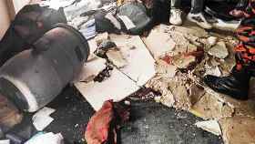 গ্যাস লাইন লিকেজ থেকে আগুন, শিশুসহ দগ্ধ ৩