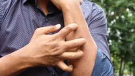 মানুষের চুলকানি দূর করেই মাসে ১৪ লাখ টাকা আয়!
