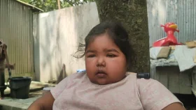 ১৫ বছর ধরে অসুস্থ জুঁই চায় স্বাভাবিক জীবন