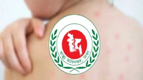 হামের উপসর্গে আরও চার শিশুর মৃত্যু