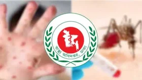 একসঙ্গে হাম-ডেঙ্গুর চাপে বাড়ছে উদ্বেগ